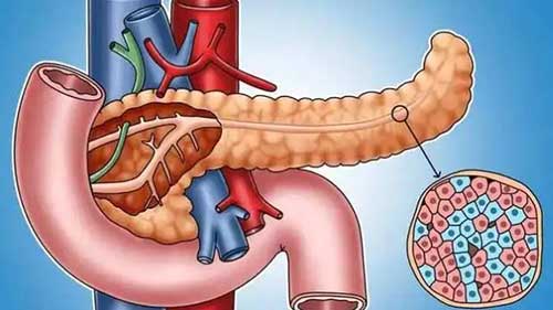 内分泌学讲座：糖尿病