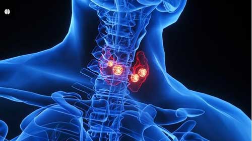 内分泌学讲座：甲亢