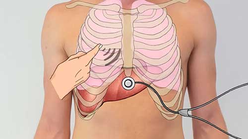 临床检查：肝脏检查