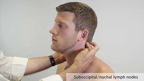 临床检查：淋巴结检查