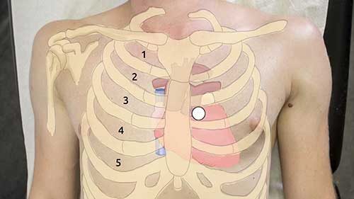 临床检查：心脏检查