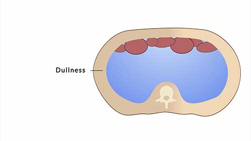 临床检查：腹部检查