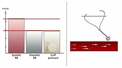 临床检查：测量血压