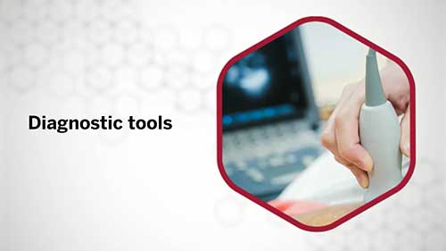 肺动脉高压：诊断