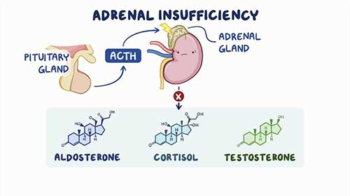 什么是肾上腺功能不全