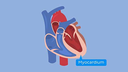 什么是心肌炎