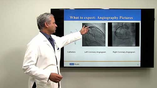 冠状动脉造影与支架介入治疗