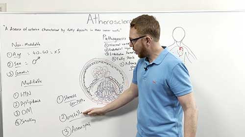 动脉粥样硬化健康知识讲座