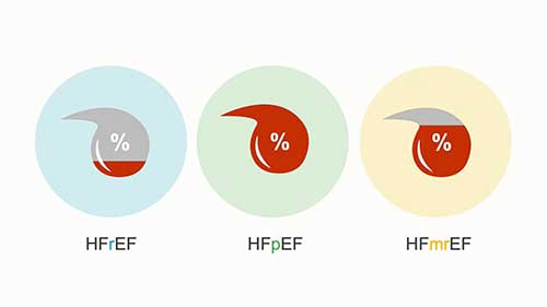 左侧心力衰竭的分类