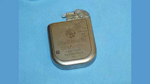 心脏起搏器手术介绍