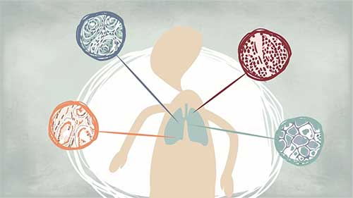 白血病是如何引起的