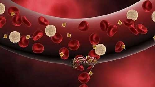 血小板减少症基础知识