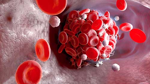 血友病基因疗法