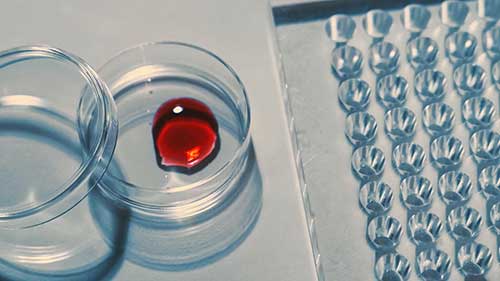 血友病治疗的演变