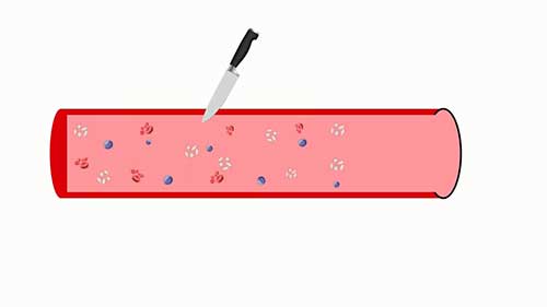 解读凝血检查报告