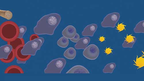 解读骨髓瘤检查报告