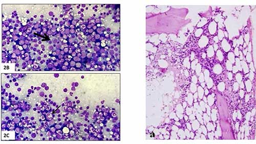 血液学研究综述