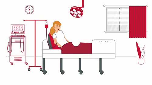 异基因造血干细胞移植