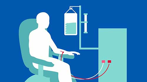 专家解读肾脏疾病