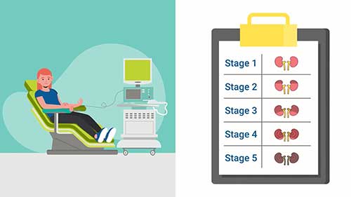 慢性肾脏病如何分期
