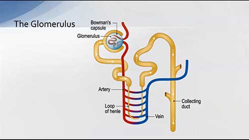 如何识别肾小球肾炎