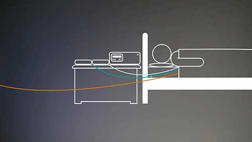 肾衰竭的腹膜透析