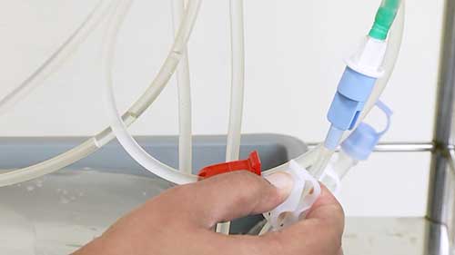 自动化腹膜透析操作指导