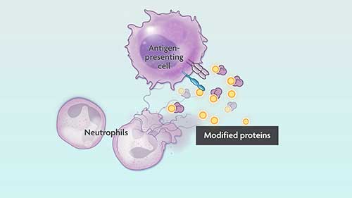 什么是类风湿性关节炎