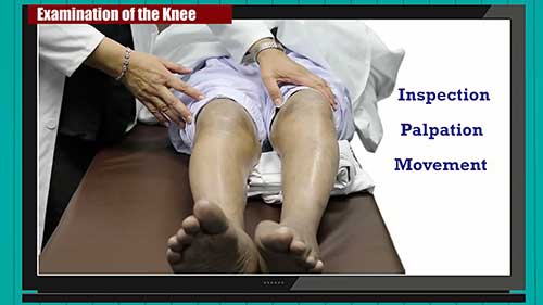 风湿病检查：膝关节