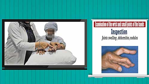 风湿病检查：手和腕关节