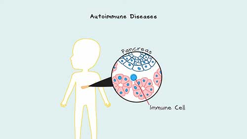 什么是自身免疫性疾病