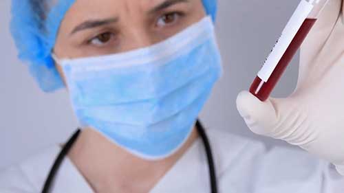 诊断自身免疫性疾病的十大测试