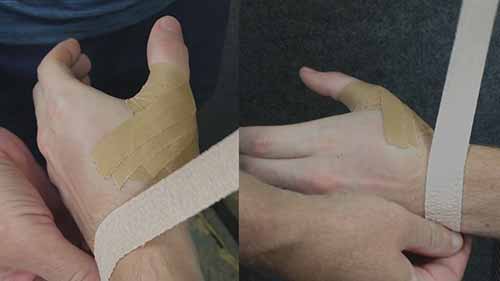 如何给大拇指及腕部绑绷带