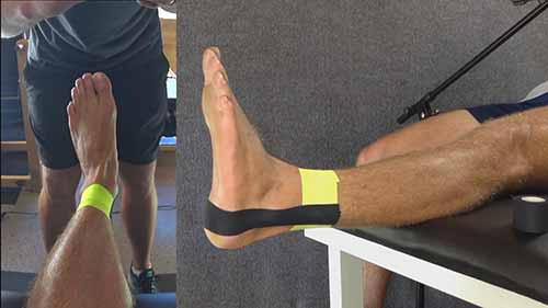 如何给脚踝绑绷带