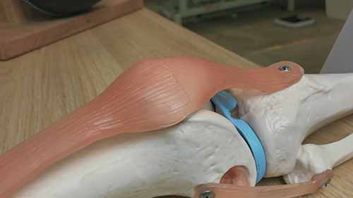 如何给膝盖绑绷带