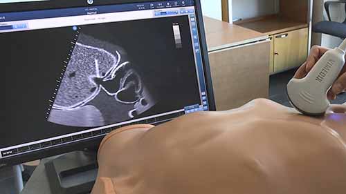 超声波机器的3D成像