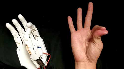 低成本的3D打印假手