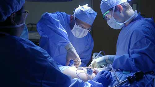 活体肾脏移植手术