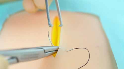 简单的间断缝合