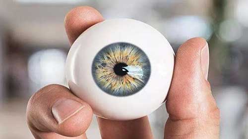 移除虹膜植入物