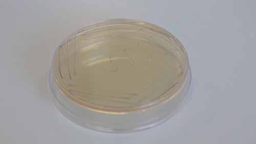 在培养皿上分离细菌