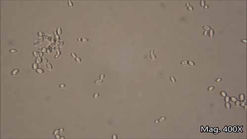 显微镜下的面包酵母