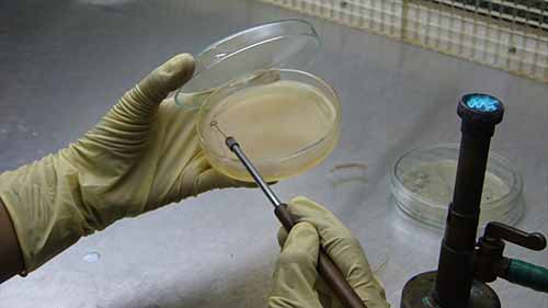 平板分离技术分离细菌