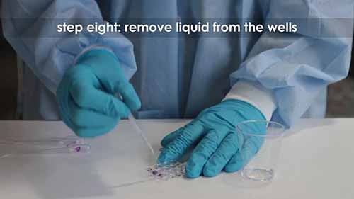 酶联免疫吸附测定