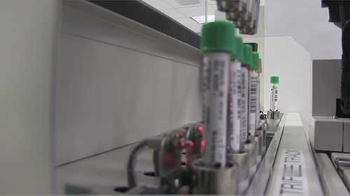 电机的线性运动控制