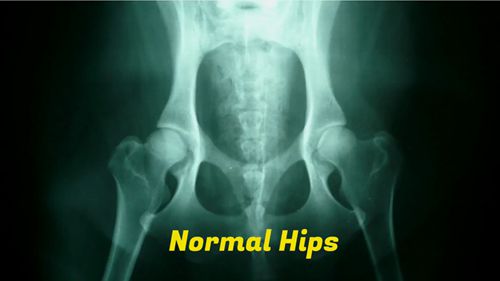 狗髋关节发育不良问题