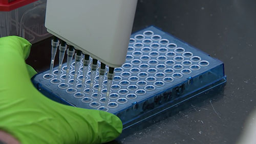 污水中的新冠病毒