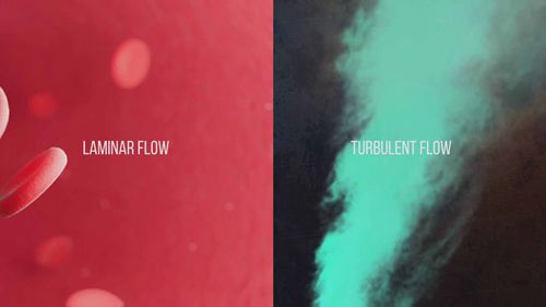 了解层流和湍流