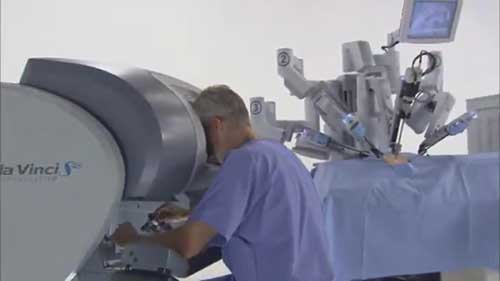 达芬奇机器人手术系统