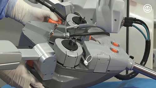 世界领先的机器人手术系统